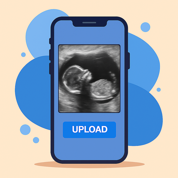 Upload Your Baby's Sonogram